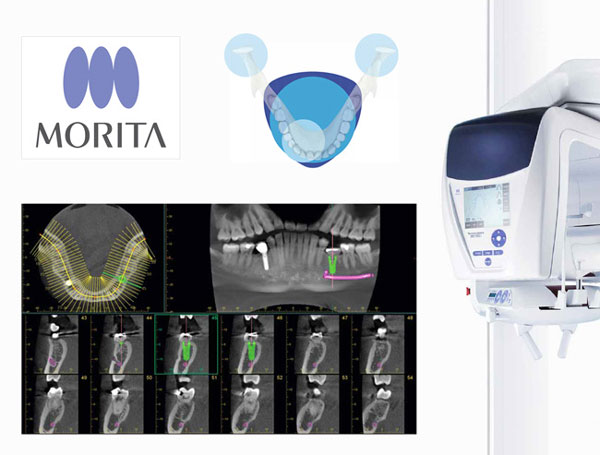 Radiologie - morita